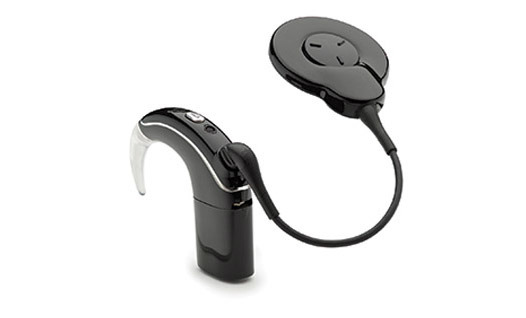 cochlear nucleus 5 recall