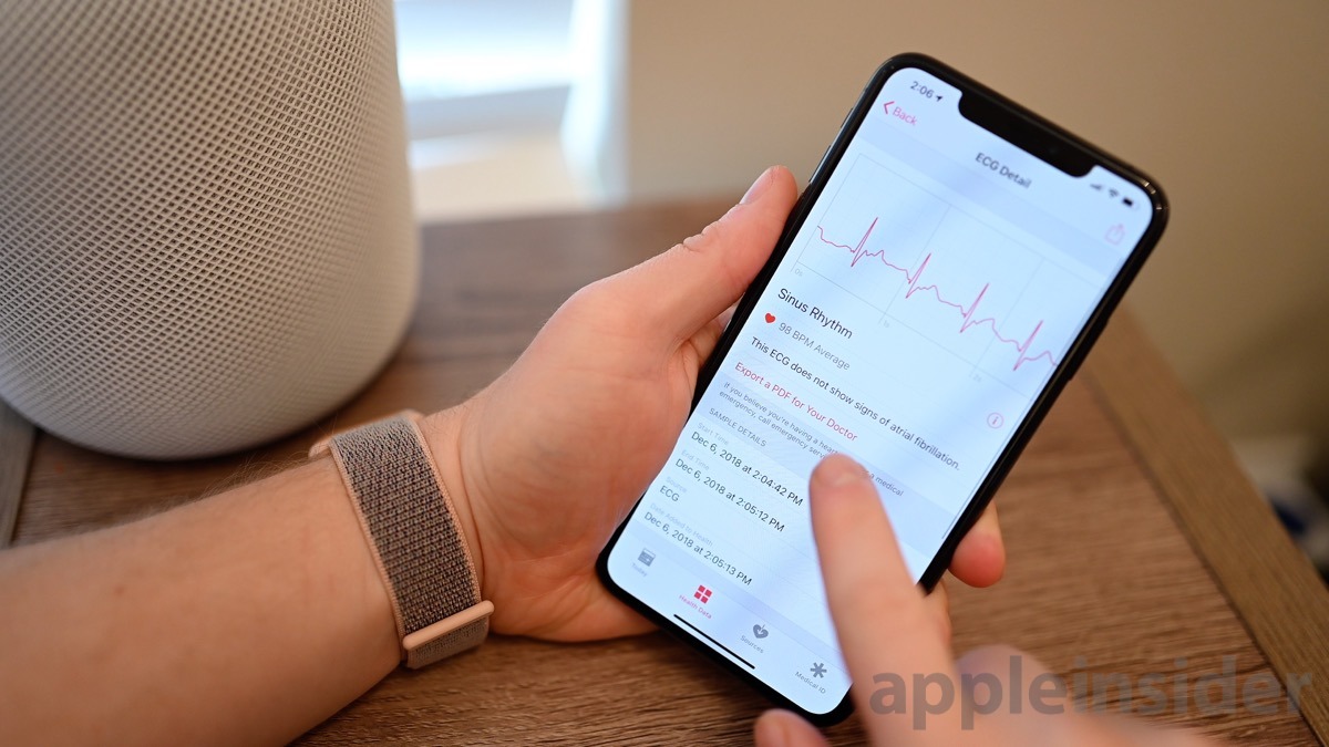 Apple Watch ECG results in the Health app