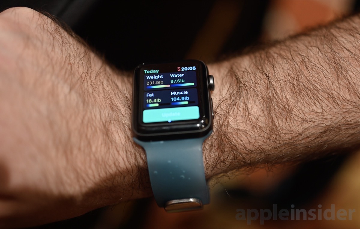 photo of Aura Band adds additional health tracking smarts to Apple Watch image