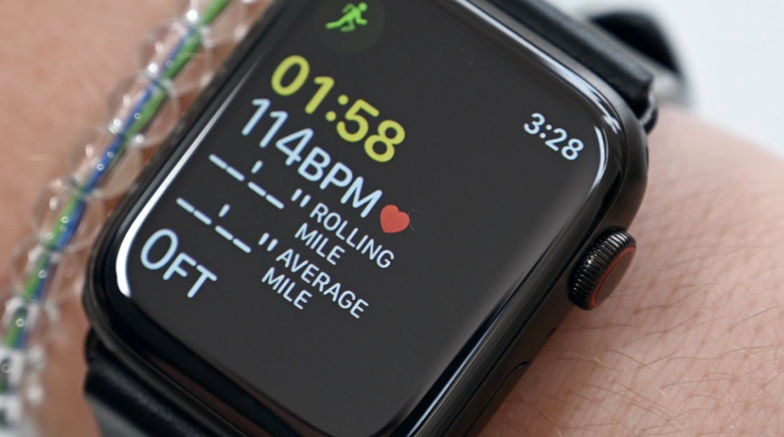 photo of Apple Watch alerts YouTuber to potential tachycardia image