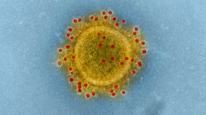 A coronavirus, recognizable by its crown-like halo