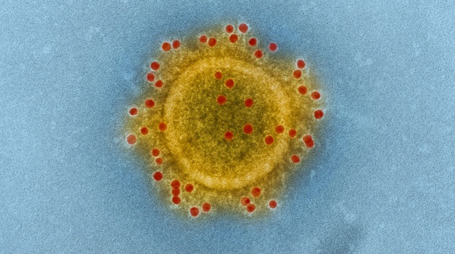 The coronavirus can be identified by its halo like ring