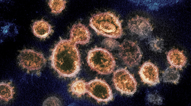 A coronavirus, recognizable by its crown-like halo