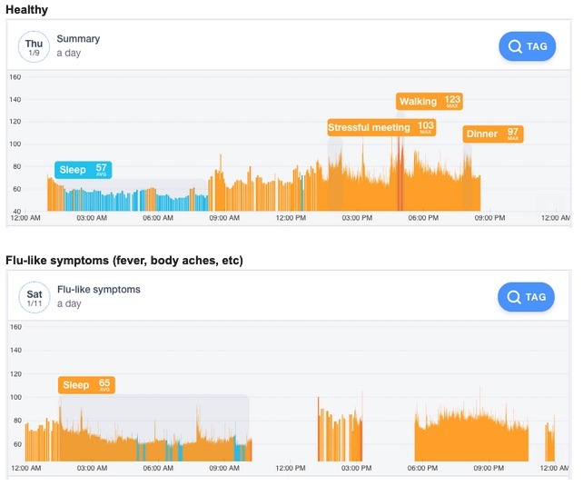 Data from Johnson Hsieh's Cardiogram app, showing differences between sleep during good health and sickness.