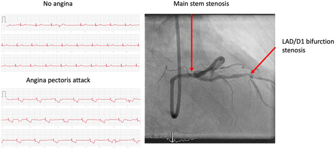 Apple watch best sale ecg looks weird