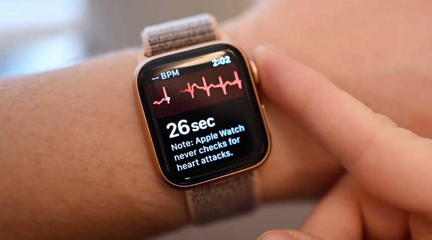 Electrocardiogramme apple watch online 3