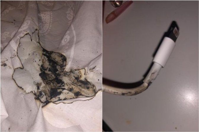 English teenager suffers facial burns after iPhone charger catches fire
