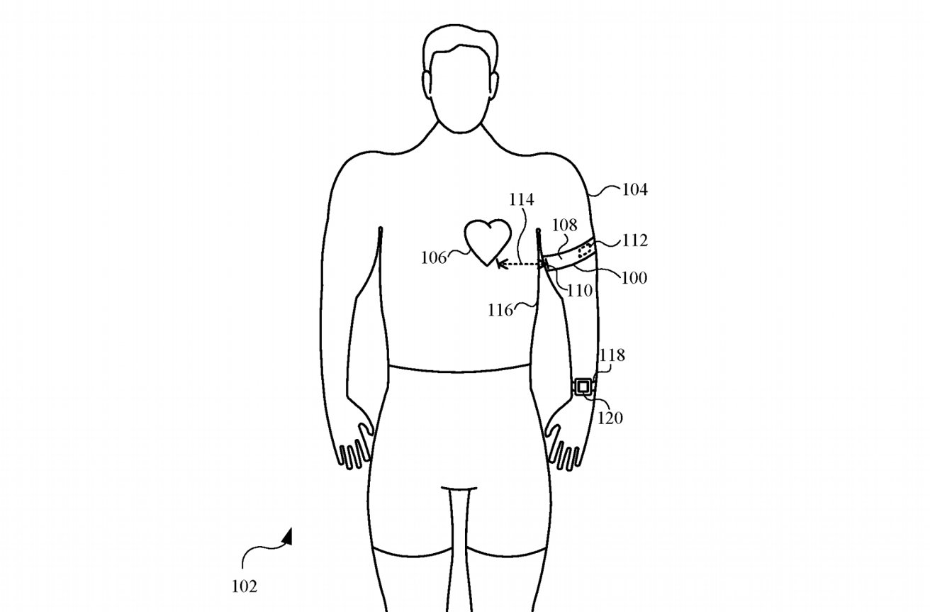 An armband could have aided ECG measurements for the Apple Watch. 