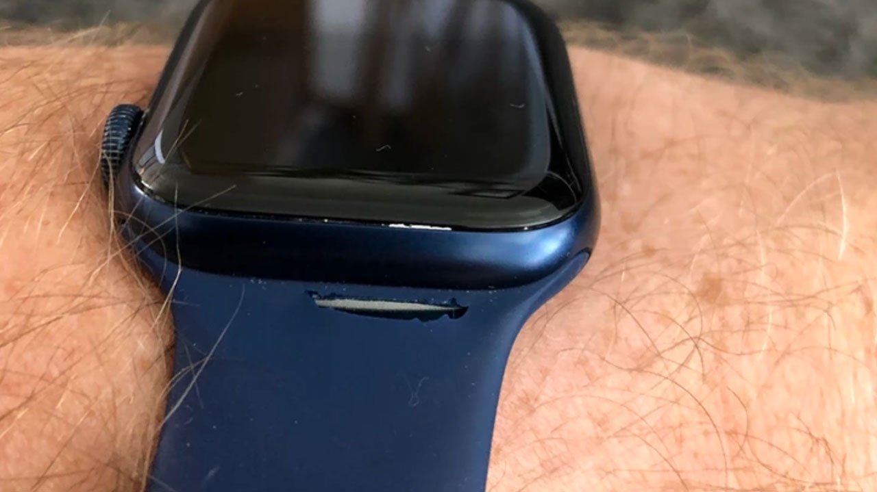 Some Apple Watch Solo Loop users complain of tearing breaks