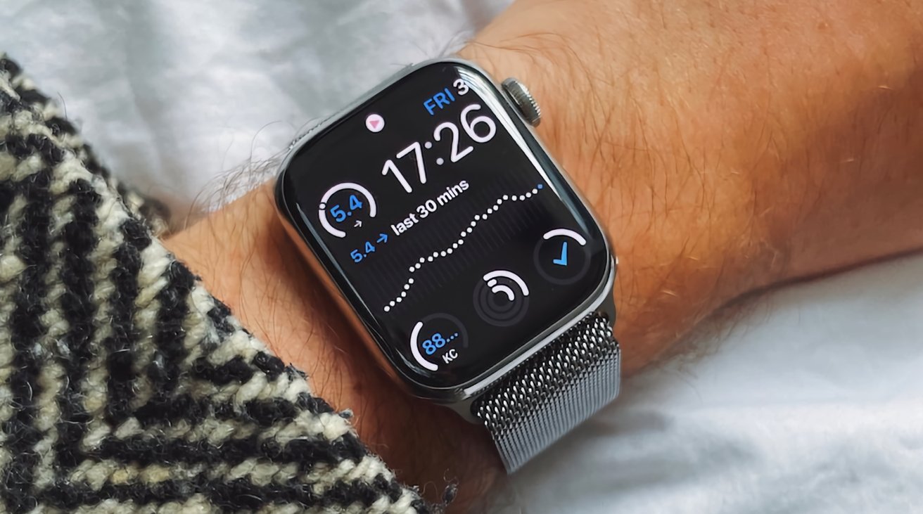 Le projet Homebrew ajoute une surveillance continue du glucose à l'Apple Watch