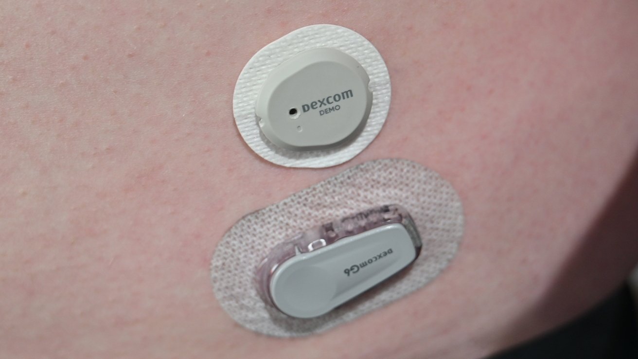 First look New G7 glucose monitor AppleInsider