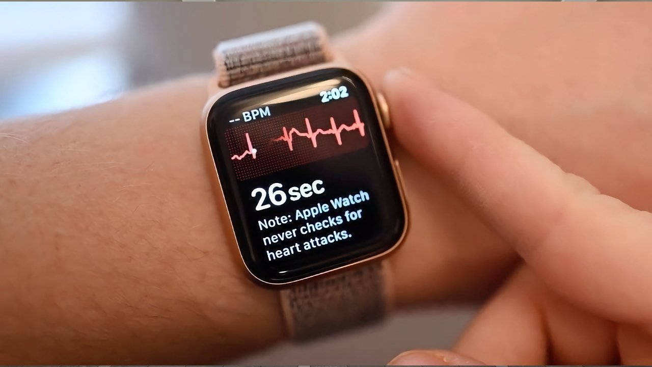 Apple Watch can act as reliable accurate stress indicator