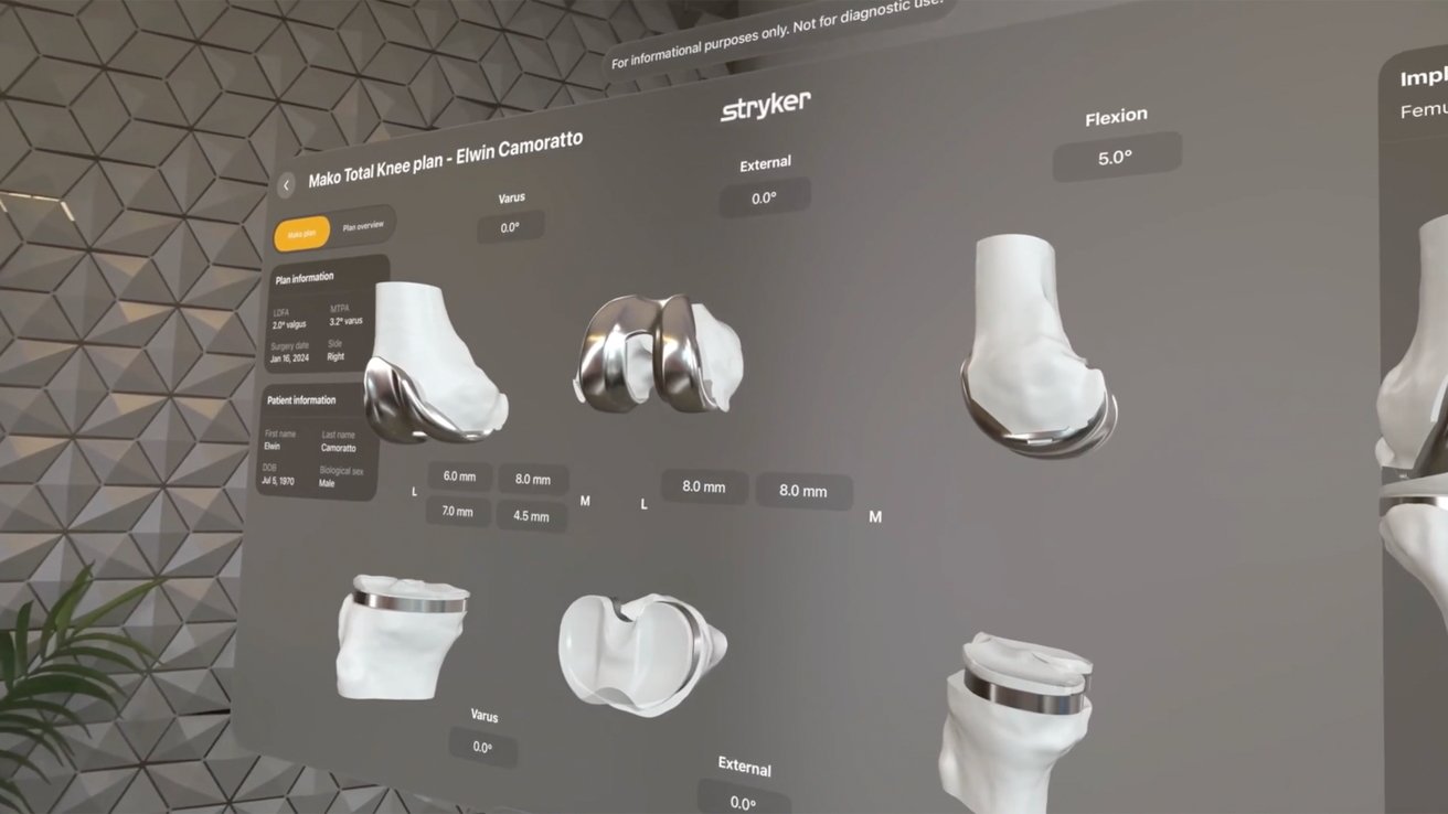 A digital display showing a knee replacement plan with various prosthetic components and patient information on a gray background.