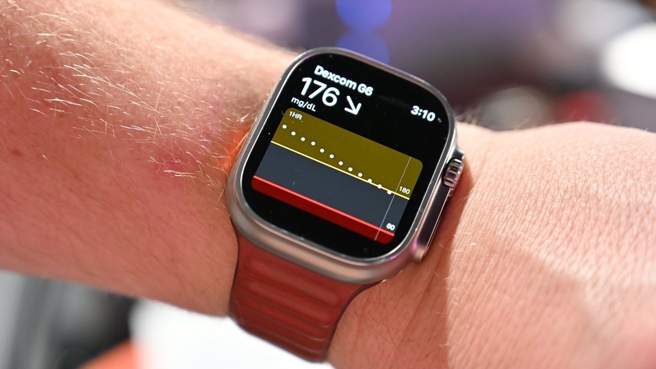 Smartwatch on a wrist displaying blood glucose level of 176 mg/dL with a downward trend arrow.