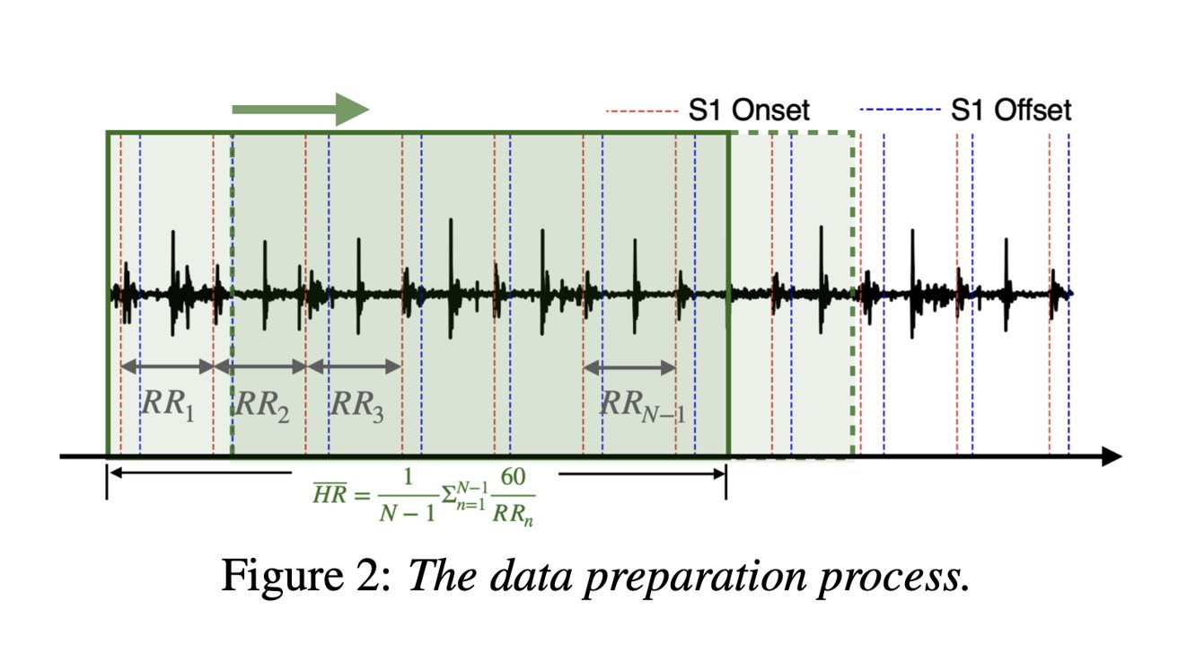Electrocardiogram trace with labeled intervals, S1 onset and offset lines, and heart rate formula for data preparation process.