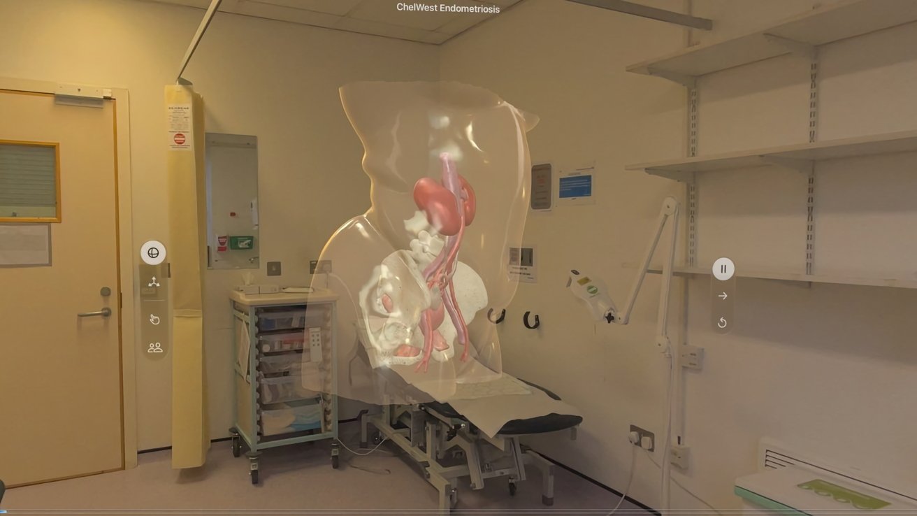 UK hospital uses Apple Vision Pro to help patients visualize surgeries